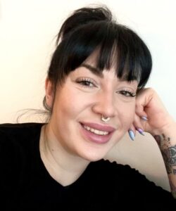 Iida Suuniitty Invisalign-oikomishoidon jälkeen